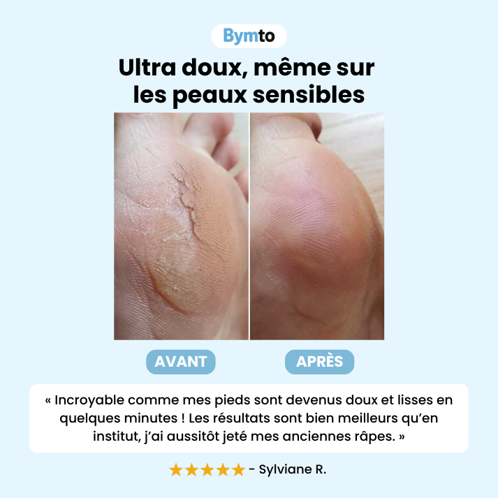 CALIO PRO®|Râpe électrique anti-callosités