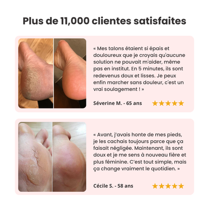 CALIO PRO®｜Pédicure électrique à domicile