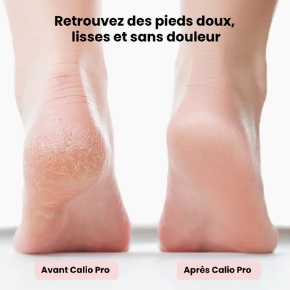 CALIO PRO®｜Pédicure électrique à domicile